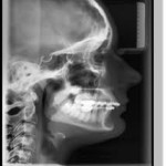 dental 3 D imaging