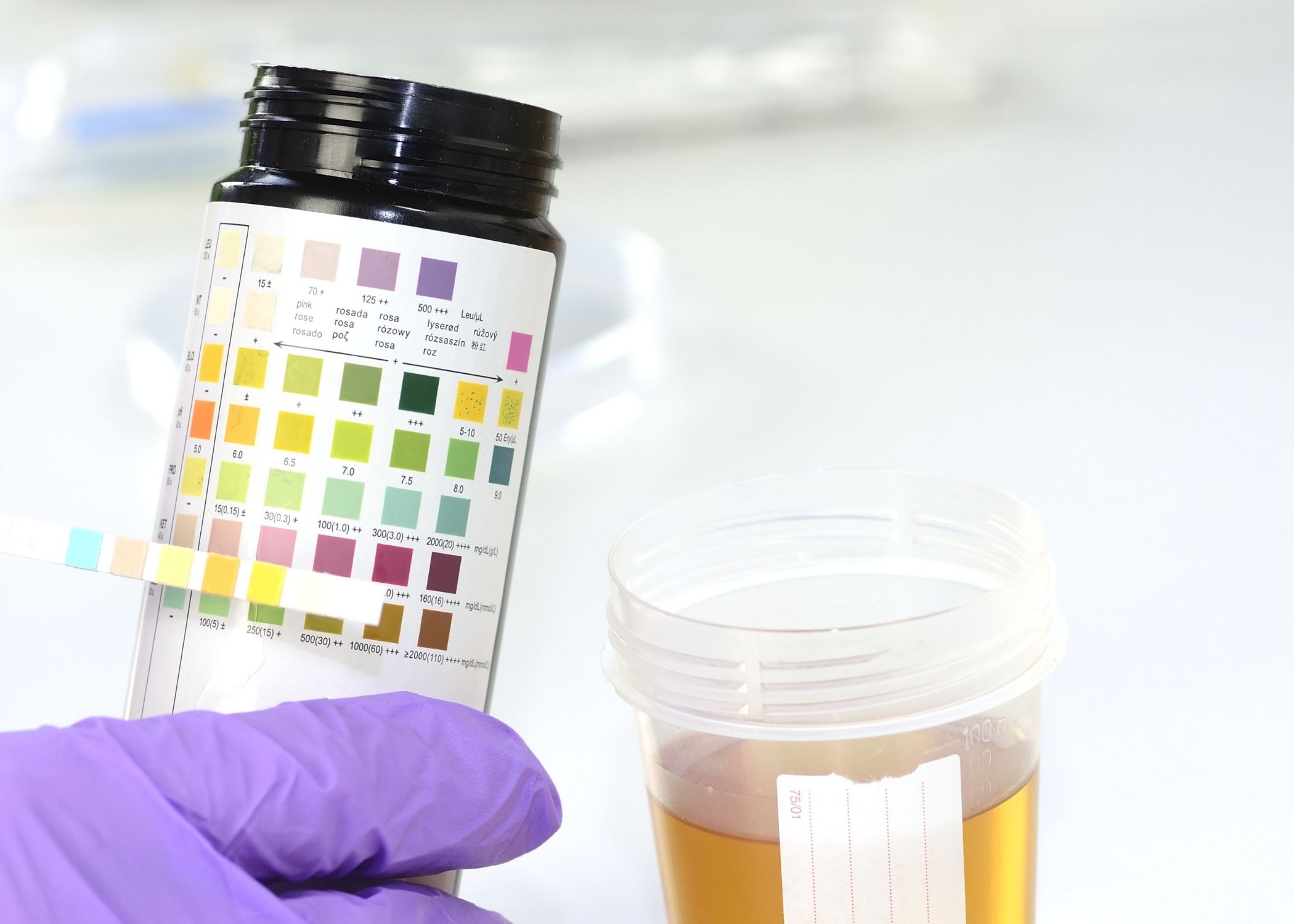 The Different Types of Drug Tests Used in the Workplace